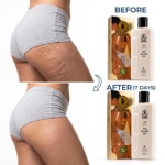 Dr James Anti Cellulite Gel Price In Dubai - Image 3